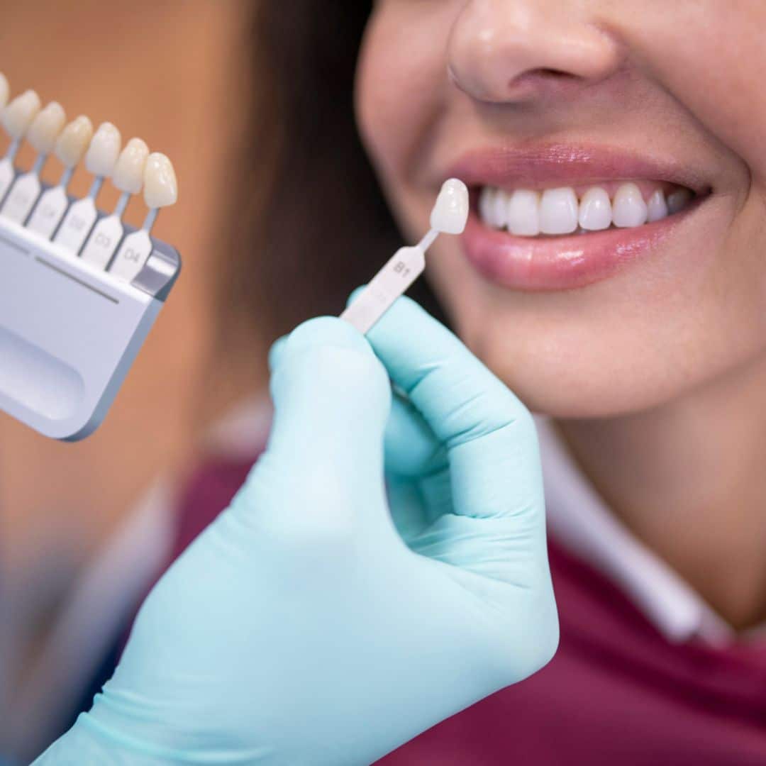 Veneers Michael Alan Rolf DMD, PLLC in Alexandria, KY